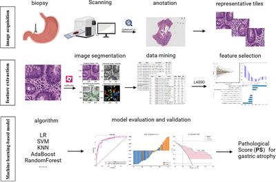 Clinical application of machine learning‐based pathomics signature of gastric atrophy